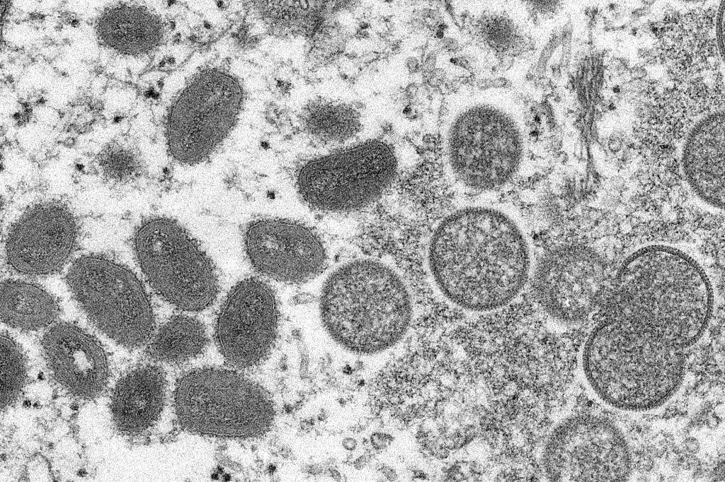 多国相继报告猴痘病例 猴痘病毒是什么？如何传播？